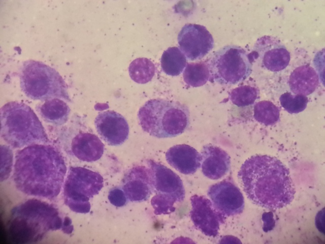 citologia_mastocitoma2